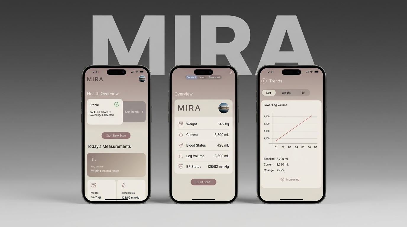 MIRA project preview